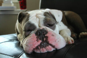 Actualités oedeme de quincke