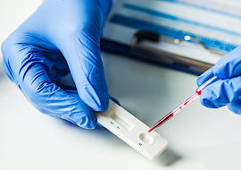 test-sanguin-rapide test sanguin rapide