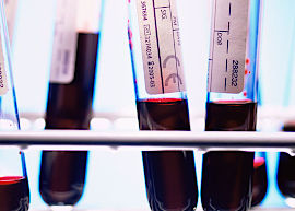 tubes-sang tubes de sang