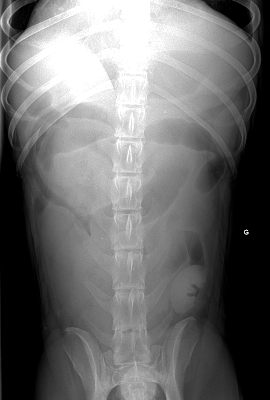 radio occlusion digestive chien radio d'occlusion digestive sur corps étranger chien