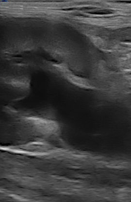 dilatation pyelique rein chat