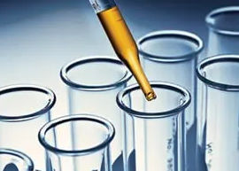 Prélèvement plasma, pour analyse