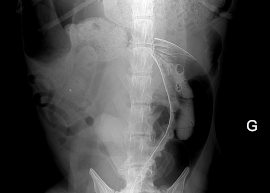 Radio torsion colon chien