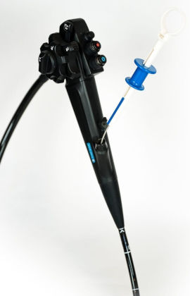 endoscopie pour extraction de corps étranger