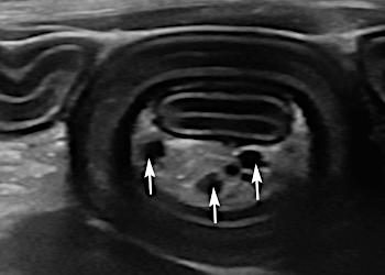 intussusception intestinale chat intussusception intestinale chat